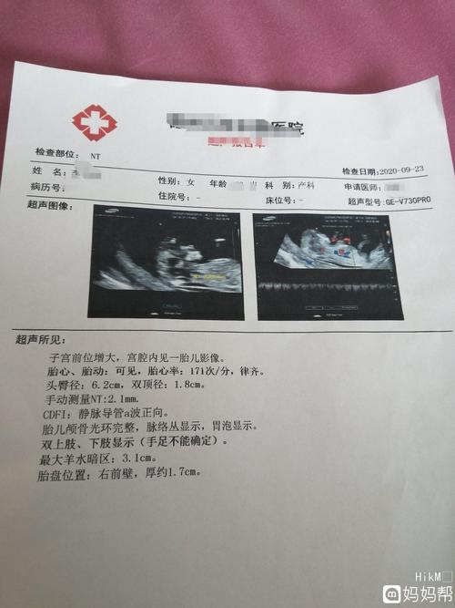 nt图像看男女准吗.咋看,帮我看看是男孩