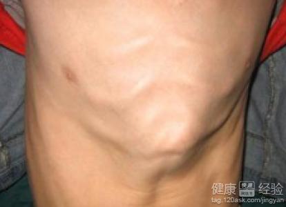 请问我家宝宝是不是鸡胸 中间老是鼓鼓的