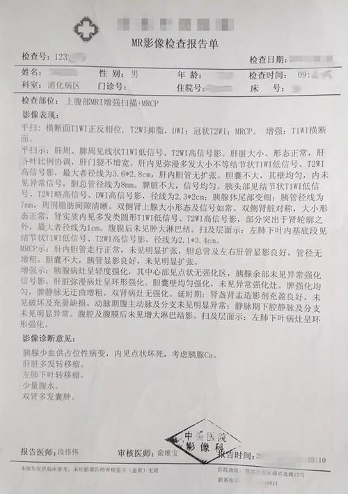 为什么大多数胰腺癌都是中晚期才被发现?
