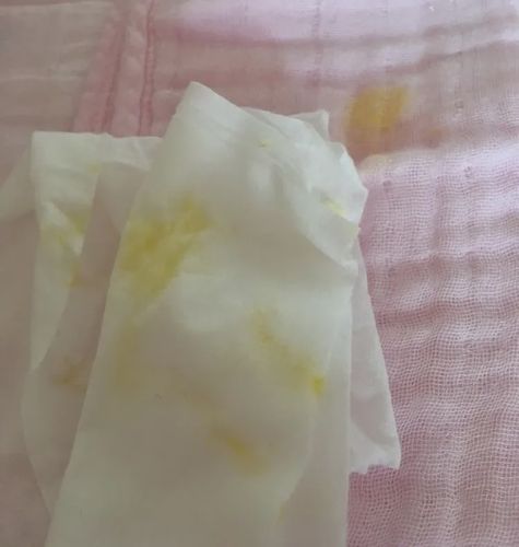 宝宝在吐奶时若吐出绿色的胆汁,有些还会有部分胃酸,形成酸