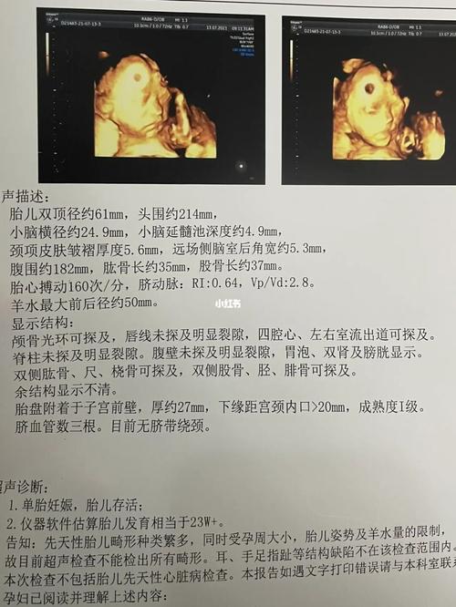 四维过了_四维彩超_胎心_女宝_四维彩超照_母婴_孕产