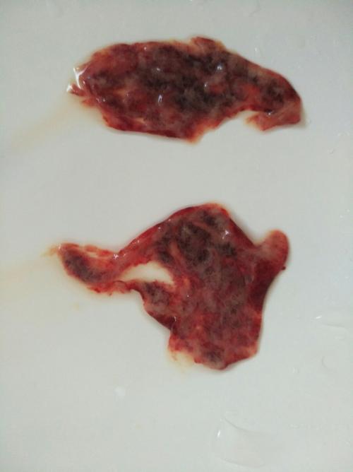 昨天生化妊辰了今天出来2团肉体请问是2个胚胎吗