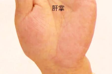 肝病可"写在"皮肤上,皮肤出现4个症状预示肝病来袭!