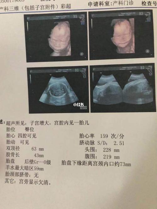 24周三维看男女还附3个月nt图