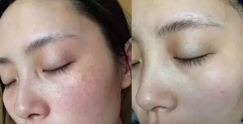 脸上色斑怕的"3种食物",每天吃一点,色斑淡了,皮肤白净了