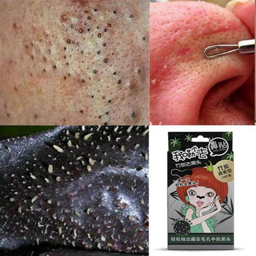 品牌竹炭去黑头鼻贴男女用鼻子祛黑头 撕拉式收毛孔面部粉刺10片