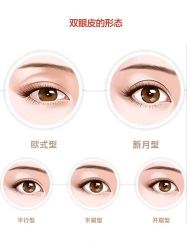 双眼皮_美颜_妆容_沈美医疗美容(南通店)自由行热门攻略_医疗美容_双