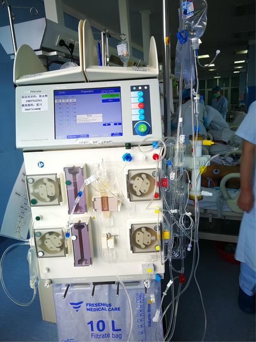 商丘市第一人民医院icu成功开展首例血浆置换治疗新技术