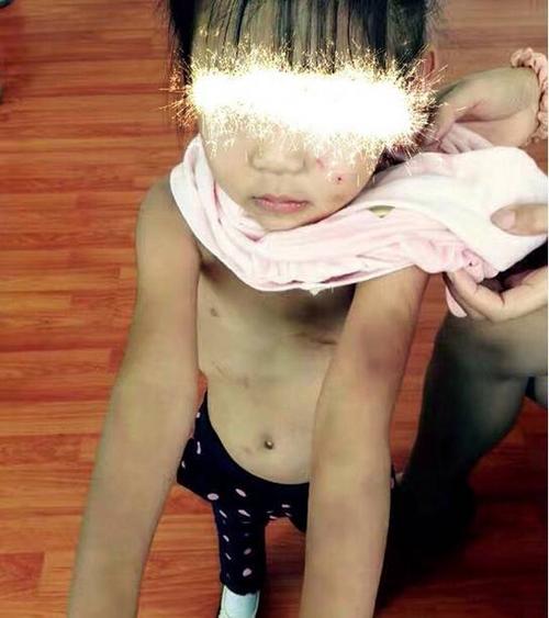 一男子到高资派出所报警,称丹徒高资镇某幼儿园内,一名小女孩遭到暴力