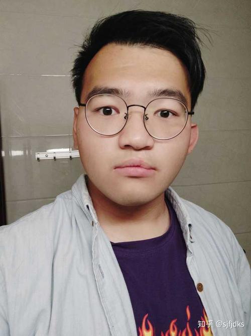 对于一个普通家庭,兔唇能修复得看起来和正常人一样吗