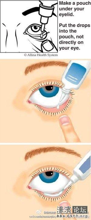 然后用一只手轻轻扒开下眼睑,将眼药水滴到下眼睑的穹窿部,也就是白