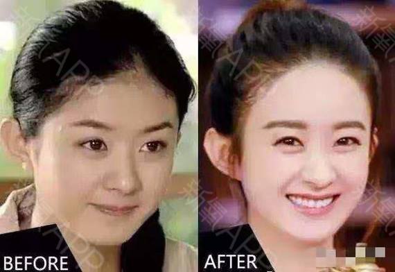 美学科普,发际线的神奇作用[:136][:63]最_圈子-新氧