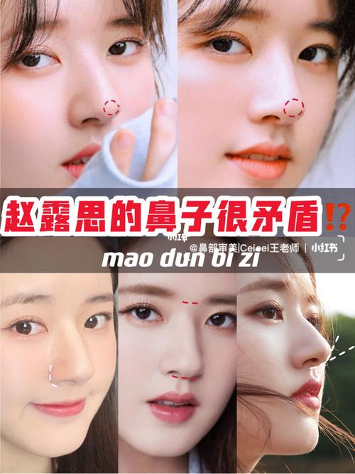 【鼻部审美】为什么赵露思的鼻子那么矛盾?