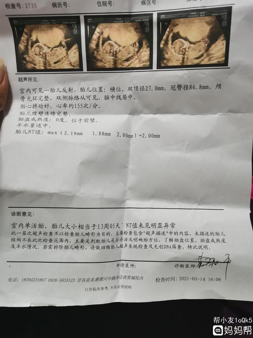 nt秒过,看这胎心率,一定是女孩子了