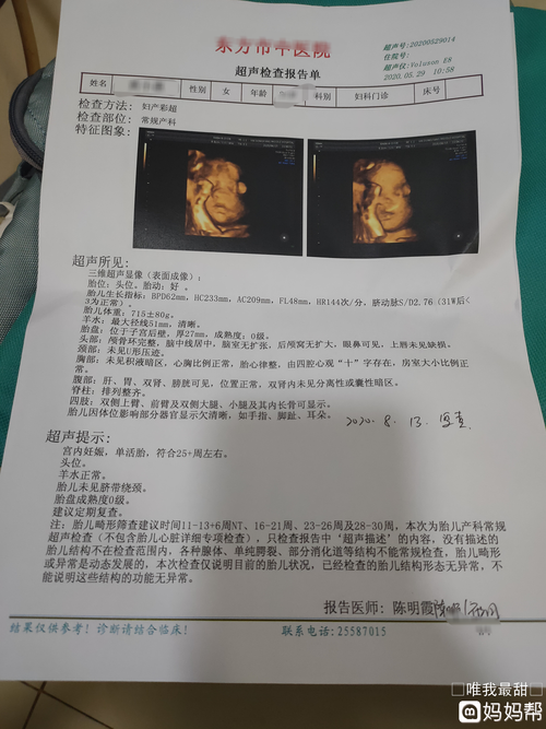 四维彩超做了两次才通过,不知男宝宝还是女