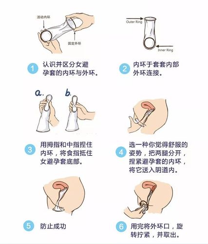 "女用避孕套"是个啥?我打开了新世界的大门!