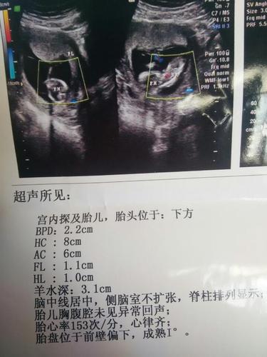 怀孕三个月看不出男孩女孩吗?昨天刚做的闭超.成熟都"i了,还看不见吗?