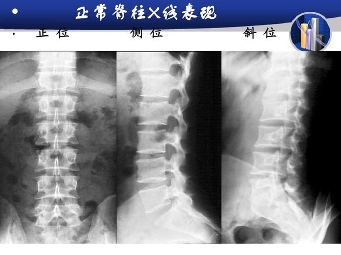研究生医学影像学-骨与软组织ppt