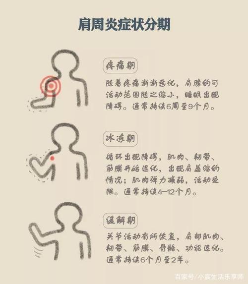 肩周炎能自愈?