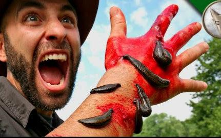 被蚂蟥(水蛭)咬伤的正确处理方法