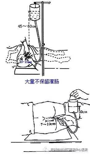 宝贝发烧去医院医生让灌肠,灌肠对孩子好不好?有没有啥危害?