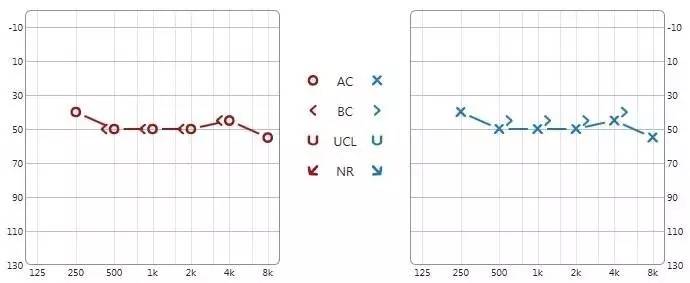 经过nal-nl1公式的首次验配,左右耳增益曲线如下所示