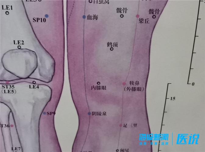 【医说】德州市中医院主治医师张方涛:针灸治疗风湿性膝关节炎有特效