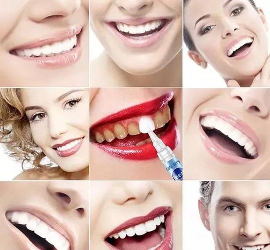 牙齿亮白如新 绽放自信笑容