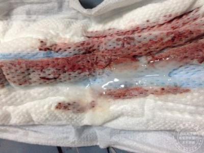 裤子看出卫生巾痕迹图
