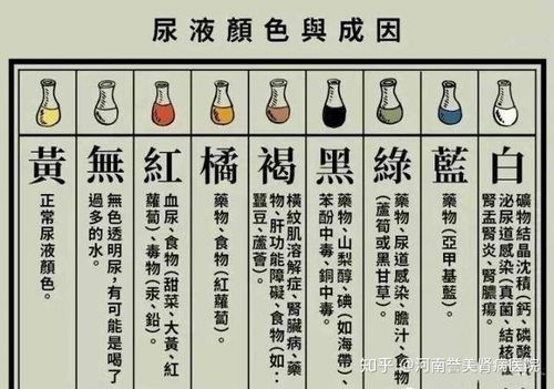 我是乙肝患者,晨尿突然出现浓茶色尿,白天尽量多喝水,颜色变淡,但稍微