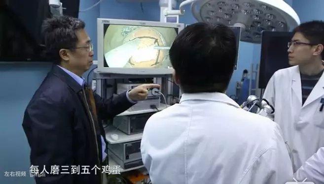 张亚卓是北京天坛医院的 脑外科专家,给鸡蛋去壳是他训练博士学生的