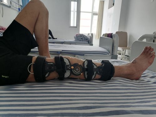 膝关节侧副韧带撕裂,只是简单打个石膏吗? no!