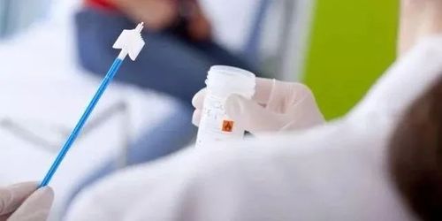 定期进行tct筛查,准确敏感地发现早期宫颈癌及癌前病变,并积极治疗