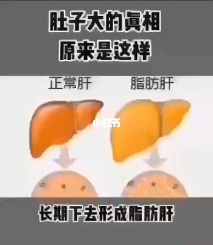 肚子大=内脏脂肪 胖了后身体会感觉特别累,那是因为心