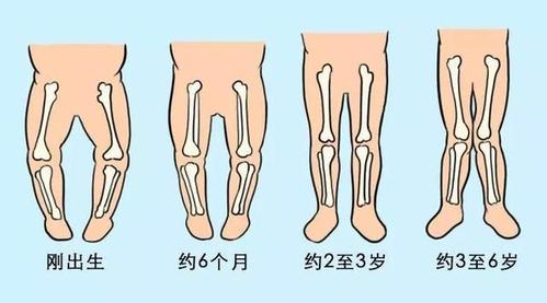 比如维生素d,就会导致宝宝的骨骼生长异常而影响到腿型;宝宝患有佝偻