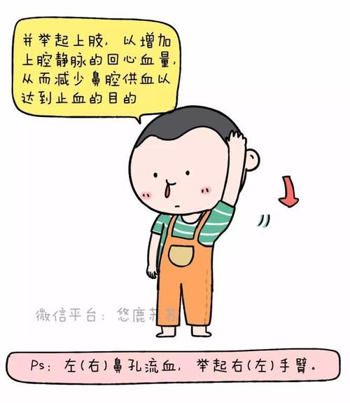 宝宝鼻出血家庭鼻笸冀!