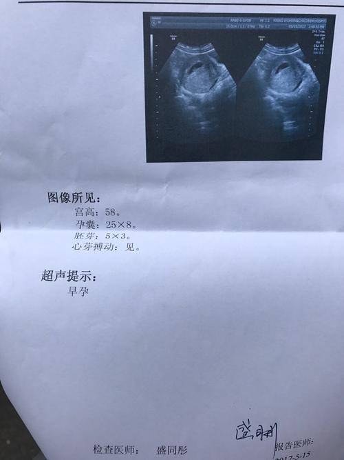 怀孕36天有孕囊胎心宝妈们帮忙看看看得出男女吗