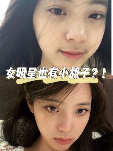 很多女明星,比如林依晨,杨丞琳,欧阳娜娜,早期的活动图里都能发现唇毛