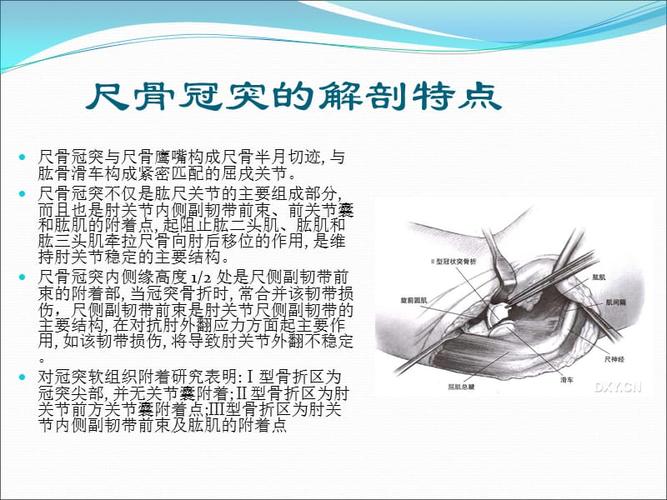 尺骨冠突骨折ppt