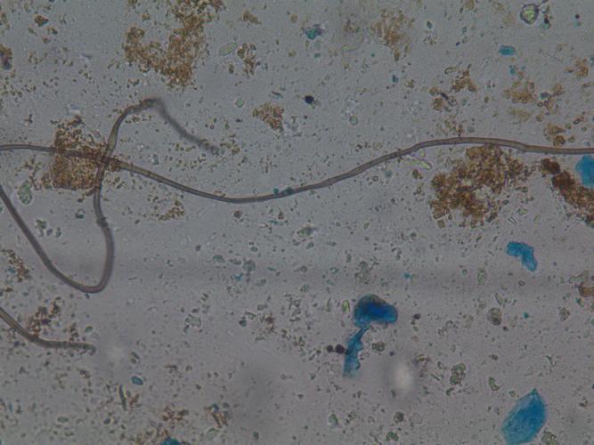 显微镜下判断是否为霉菌