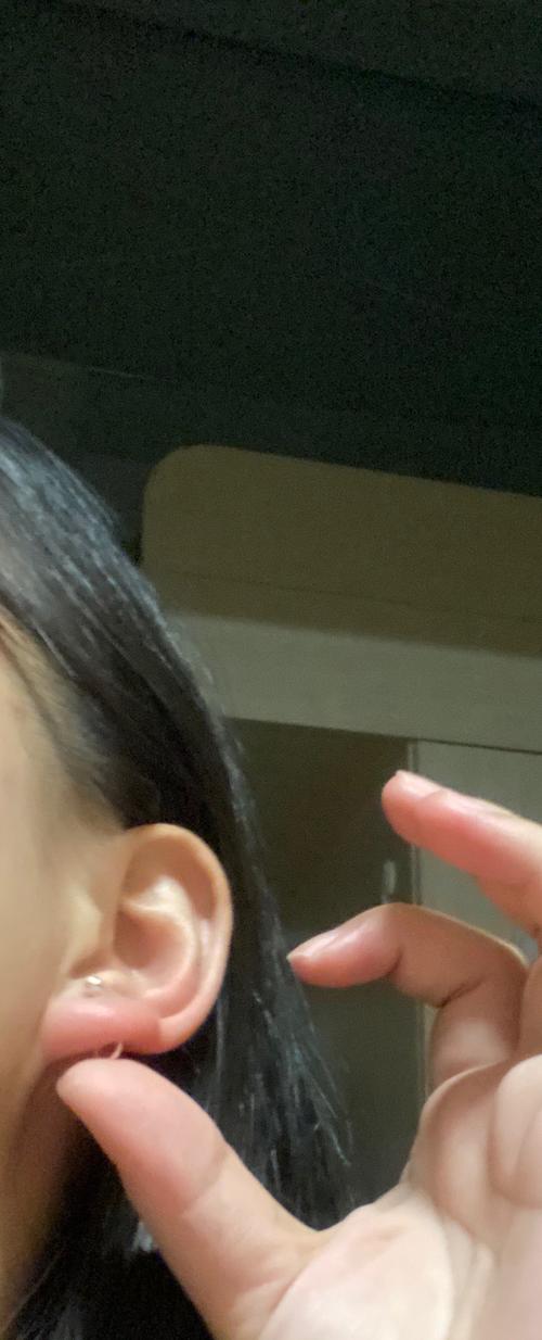 打耳洞两个月了居然突然肿了怎么办啊