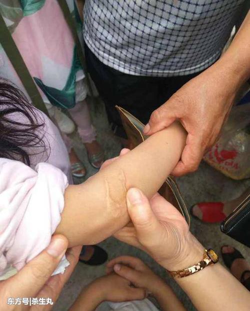 女童遭怀孕继母虐待 父亲怒阻曝光:不想失去老婆