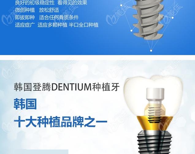 韩国登腾种植体的优势