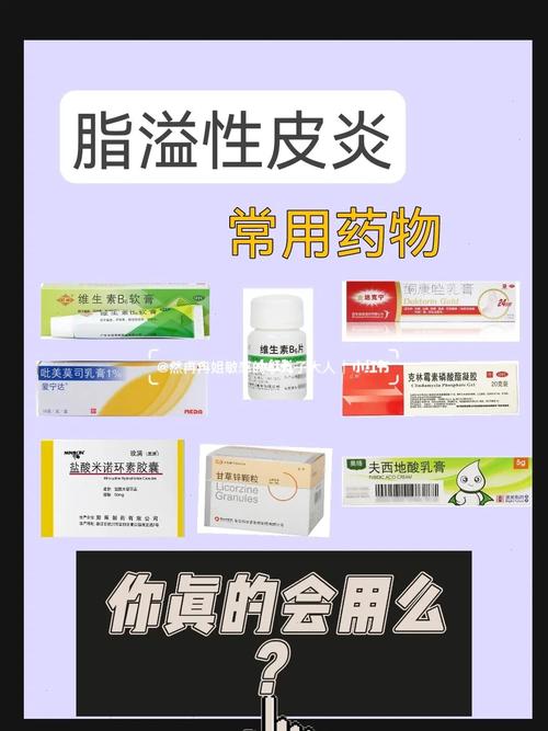 脂溢性皮炎 外用内服药   经验之谈_脂溢性皮炎_软膏
