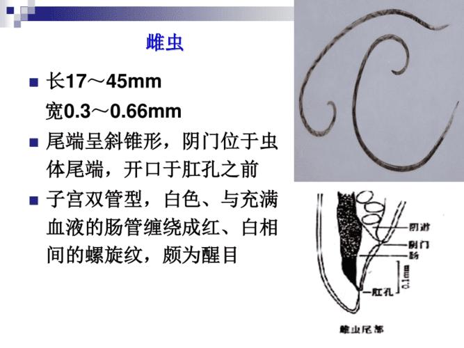 临床寄生虫检验本科第五章神经系统寄生虫广州管圆线虫 ppt