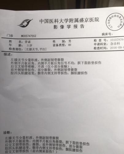 曾诚的诊断报告,诊断确认为后交叉韧带损伤.微博 图