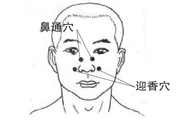 【健康】教你几招过敏性鼻炎的预防方法,效果特别好