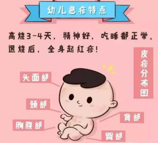 小儿发热伴皮疹护理措施(二)