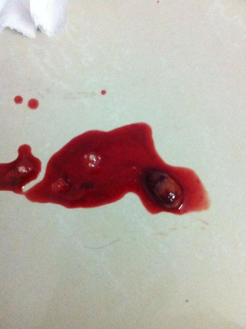 跟老公同房后他jj上面有血,起来后排出来血,今天还是排卵日,上次月经2