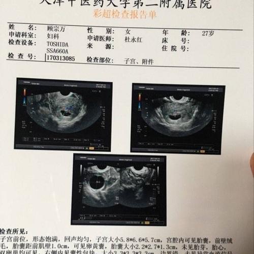 b超孕囊图片男孩